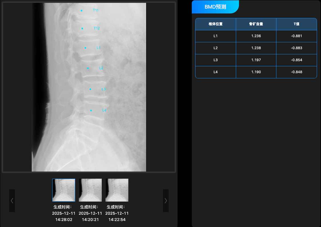 骨密度预测系统
